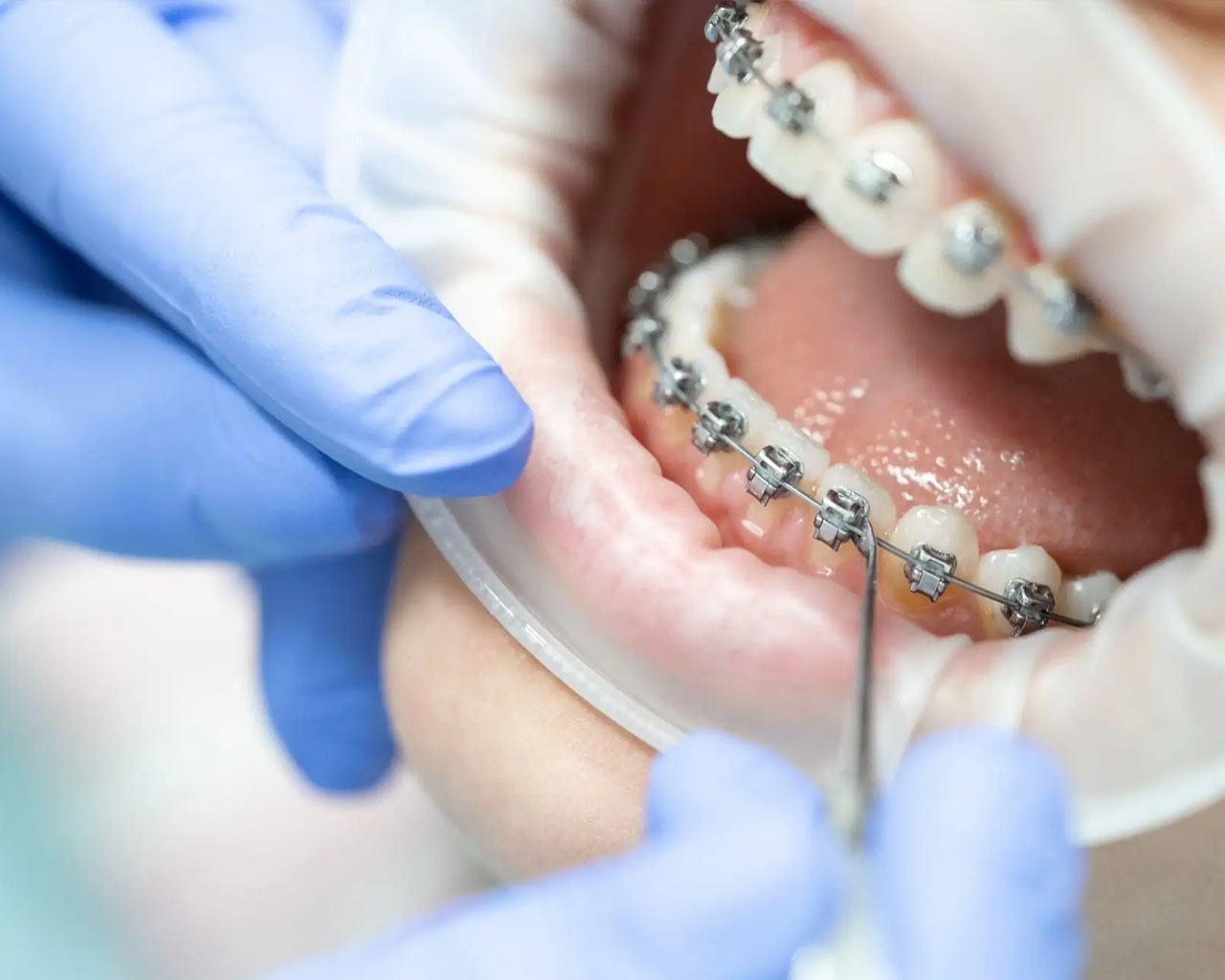 Ortodonzia - GR Dentasmile